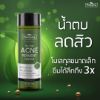 รูปภาพของ แพลนท์เนอรี่ น้ำตบสูตรลดสิว 200มล.