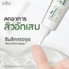 รูปภาพของ แพลนท์เนอรี่ เจลแต้มสิว 15ก.