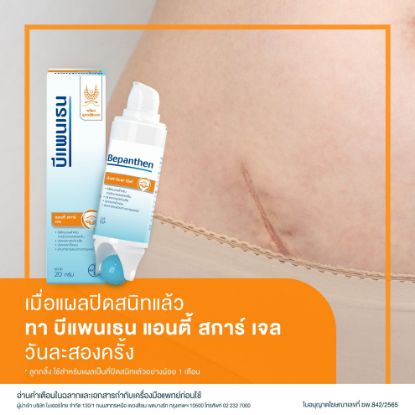 รูปภาพของ บีแพนเธน แอนตี้สการ์เจล 20 กรัม
